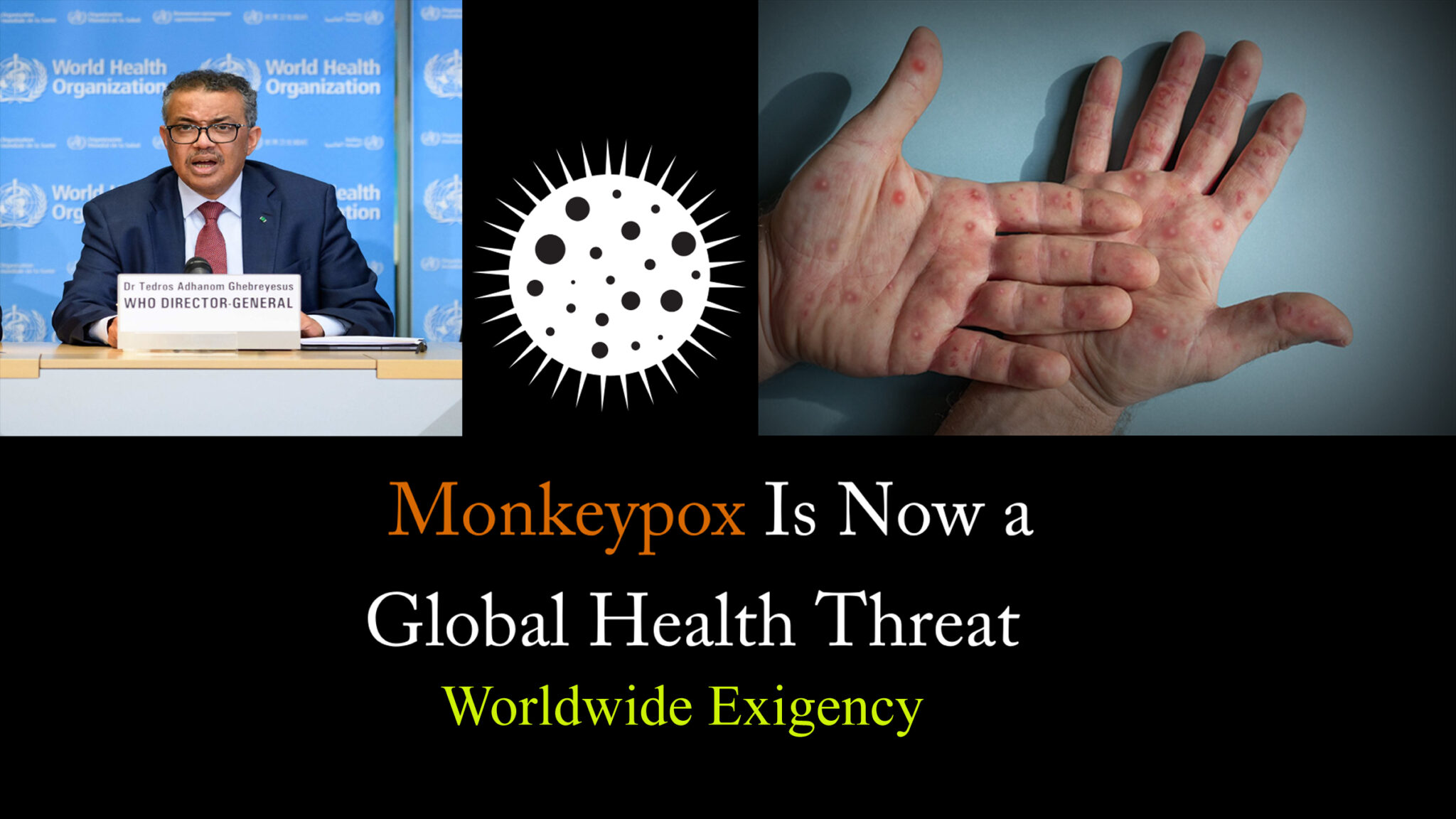 Is monkey pox a Global issue? WHO declares monkey pox a global health emergency?