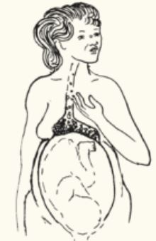How to Relieve Heartburn Symptoms during Pregnancy 